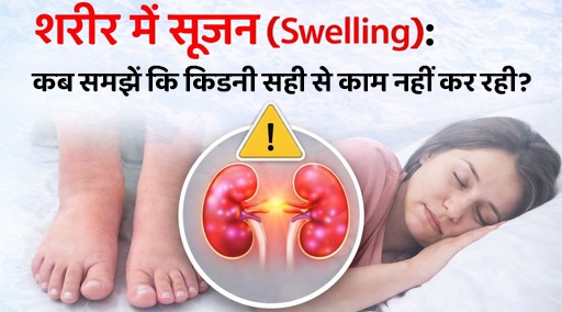 body-swelling-kidney-problem-signs