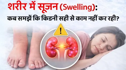 body-swelling-kidney-problem-signs