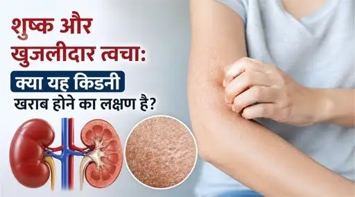 dry-itchy-skin-kidney-problem-symptoms