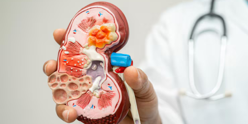 saans-phoolna-aur-kidney-bimari-ka-sambandh